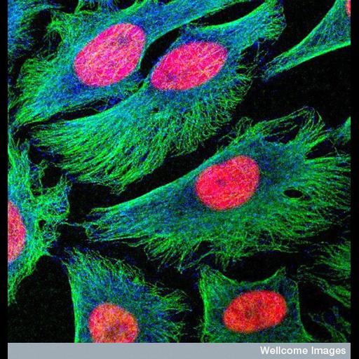  NCBI Organism:Homo sapiens; Cell Types:epithelial cell of cervix Cell Components:nucleus, microtubule, mitotic checkpoint complex; Biological process:microtubule cytoskeleton organization