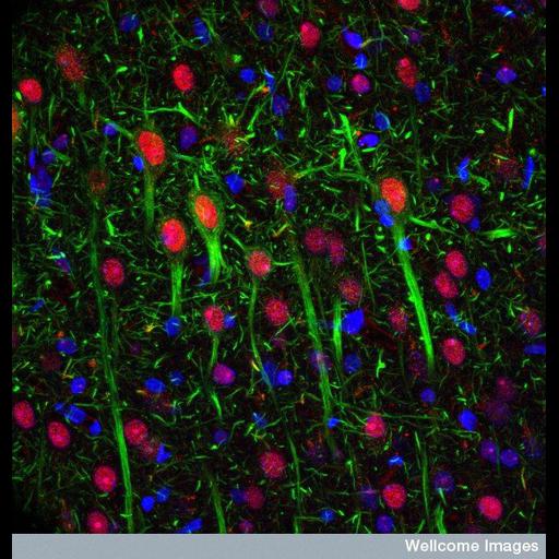  Cell Components:, neurofilament, nucleus;