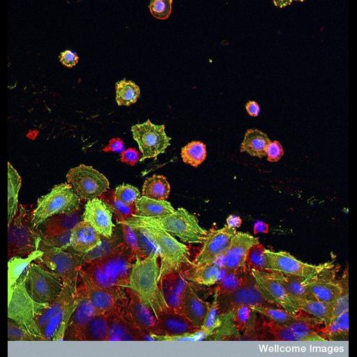  Cell Components:actin cytoskeleton, , nucleus; Biological process:cell migration