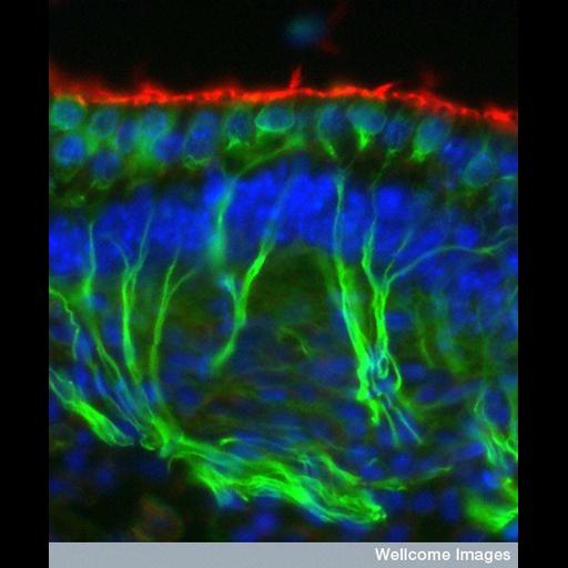  Cell Types:vestibular hair cell, neuron; Cell Components:nucleus Biological process:detection of mechanical stimulus involved in sensory perception of sound