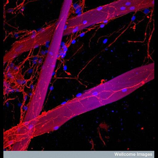  Cell Types:Schwann cell, neuron; Cell Components:neuron projection, nucleus, growth cone; Biological process:axon regeneration