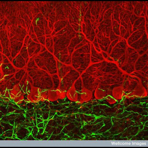  Cell Types:Purkinje cell Cell Components:neuron projection, neuronal cell body; Biological process:cerebellar Purkinje cell layer morphogenesis