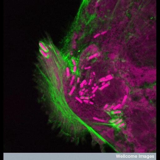  NCBI Organism:Shigella, Homo sapiens, ; Cell Types:intestinal epithelial cell Cell Components:actin cytoskeleton, , ; Biological process:actin polymerization-dependent cell motility