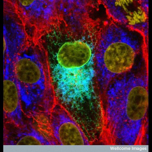  NCBI Organism:Mumps virus; Cell Components:endoplasmic reticulum, nucleus, actin cytoskeleton; Biological process:response to virus