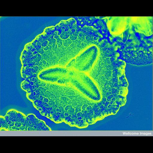  NCBI Organism:Aggregatibacter actinomycetemcomitans;