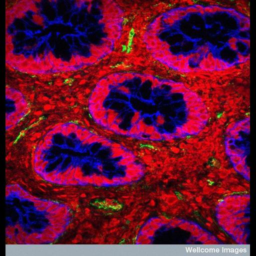  NCBI Organism:Homo sapiens, Escherichia coli, ; Cell Types:endothelial cell Biological process:Gram-negative bacterial cell surface binding, response to bacterium, detection of bacterium;