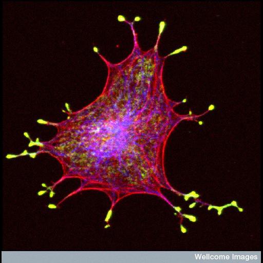  Cell Types:melanocyte Cell Components:melanosome, actin cytoskeleton, microtubule cytoskeleton; Biological process:melanosome localization