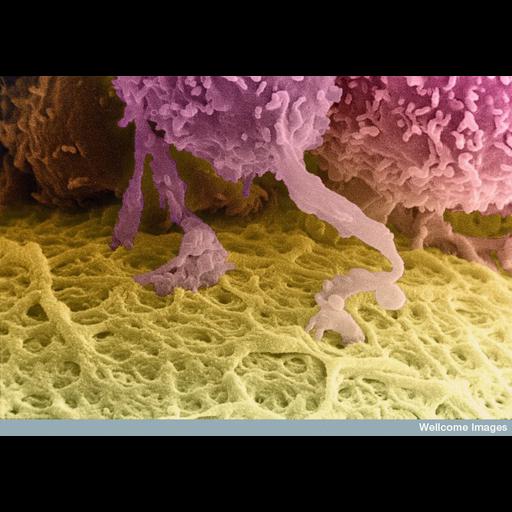  NCBI Organism:Homo sapiens; Cell Types:egg, follicle cell; Cell Components:, cell projection membrane; Biological process:, ovarian follicle cell-cell adhesion;