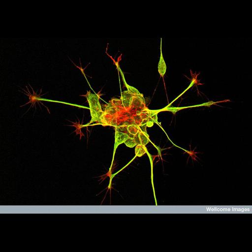  Cell Types:neuron of the dorsal spinal cord Cell Components:growth cone, microtubule cytoskeleton, actin cytoskeleton, neuron projection, neuronal cell body; Biological process:neuron migration