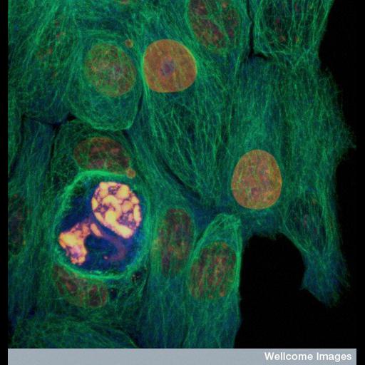  Cell Components:microtubule cytoskeleton, nucleus; Biological process:cell death