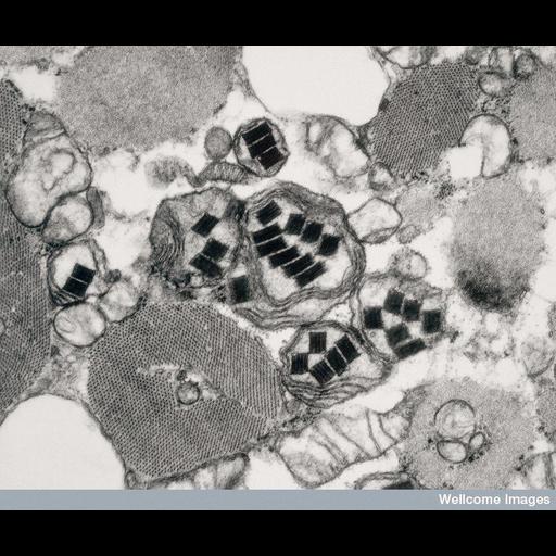  Cell Types:muscle cell Cell Components:mitochondrion