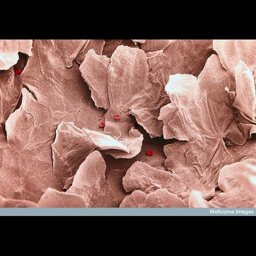  Cell Types:, ; Cell Components:cell-cell junction, cell surface; Biological process:epithelial cell-cell adhesion