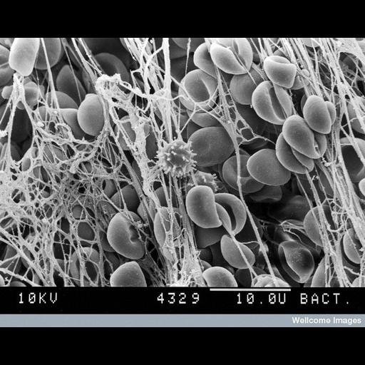  Cell Types:blood cell, , ; Cell Components:extracellular matrix, cell surface; Biological process:blood coagulation