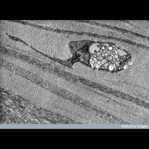  Cell Components:mitochondrion, rough endoplasmic reticulum, fibrillar collagen, nucleus;