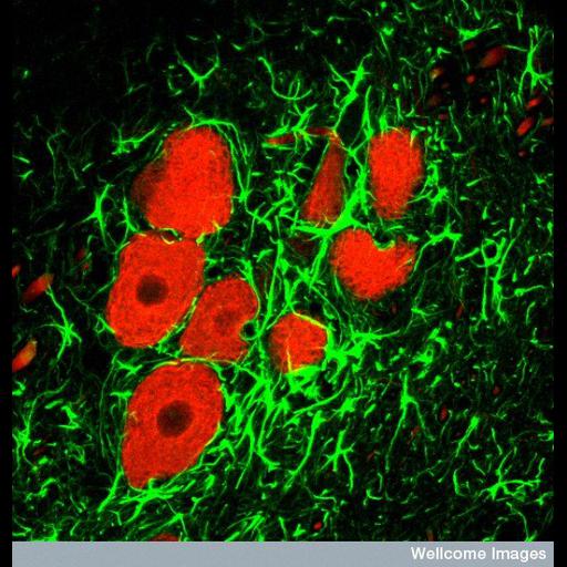  Cell Types:neuron, glial cell; Cell Components:neurofilament, , neuronal cell body; Biological process:brainstem development