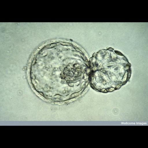  NCBI Organism:Homo sapiens; Cell Types:embryonic cell Biological process:blastocyst hatching