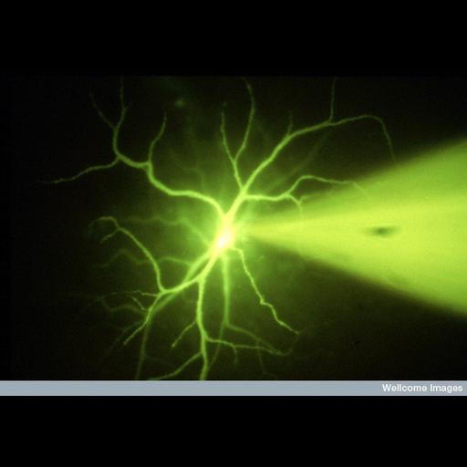  Cell Components:dendrite, neuronal cell body, dendritic branch; Biological process:dendrite morphogenesis, ;