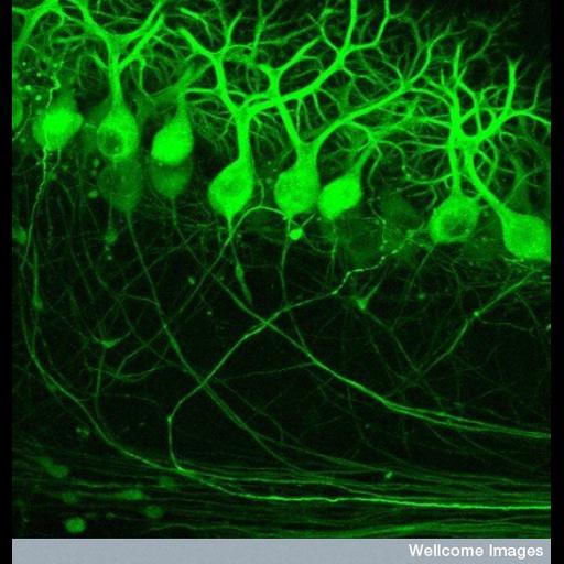  NCBI Organism:Mus musculus; Cell Types:Purkinje cell Cell Components:neuronal cell body, neuron projection; Biological process:cerebellar Purkinje cell layer structural organization