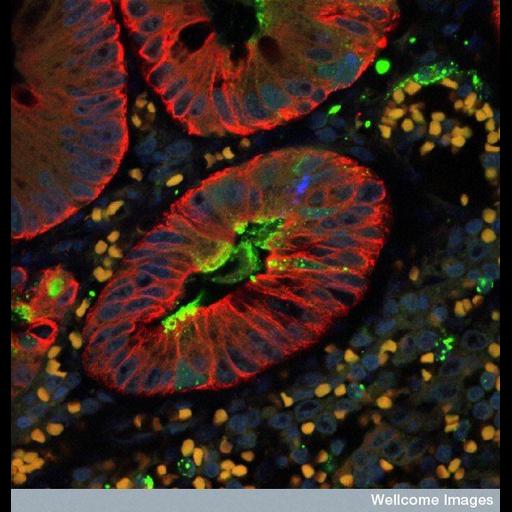  NCBI Organism:Homo sapiens, Morbillivirus, ; Cell Types:epithelial cell Cell Components:intermediate filament, nucleus, ; Biological process:viral reproduction