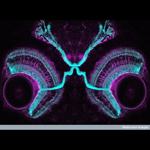  NCBI Organism:Danio rerio; Cell Types:glial cell, neuron; Cell Components:neuron projection Biological process:optic nerve structural organization, optic nerve maturation, retina layer formation;