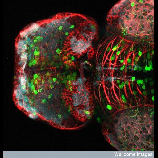  NCBI Organism:Danio rerio; Cell Types:neuron Cell Components:microtubule, synaptic vesicle, axon, ; Biological process:neuron projection development