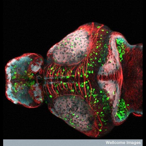  NCBI Organism:Danio rerio; Cell Types:neuron Cell Components:microtubule, synaptic vesicle, axon, ; Biological process:neuron projection development