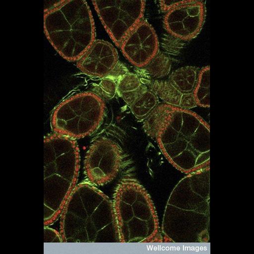  NCBI Organism:Drosophila melanogaster; Cell Types:egg, invertebrate nurse cell; Cell Components:actin cytoskeleton, nucleus; Biological process:oocyte localization involved in germarium-derived egg chamber formation