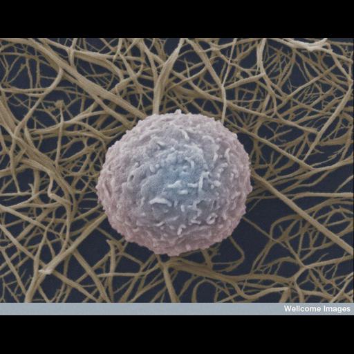  NCBI Organism:Homo sapiens; Cell Types:blood cell Cell Components:extracellular matrix, cell surface; Biological process:blood coagulation, fibrin clot formation