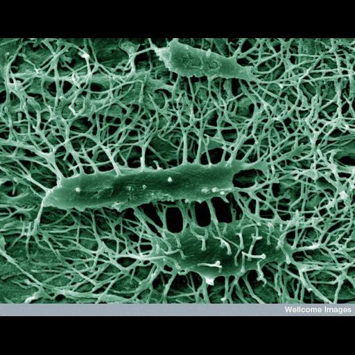  NCBI Organism:Mus musculus; Cell Types:osteocyte Cell Components:cell surface Biological process:bone morphogenesis