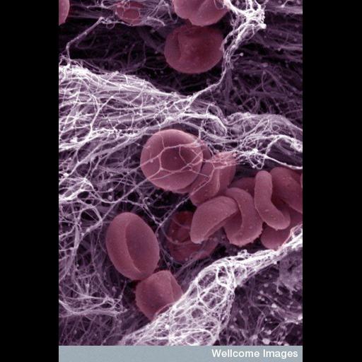  Cell Types:blood cell Cell Components:, extracellular matrix, cell surface; Biological process:blood coagulation