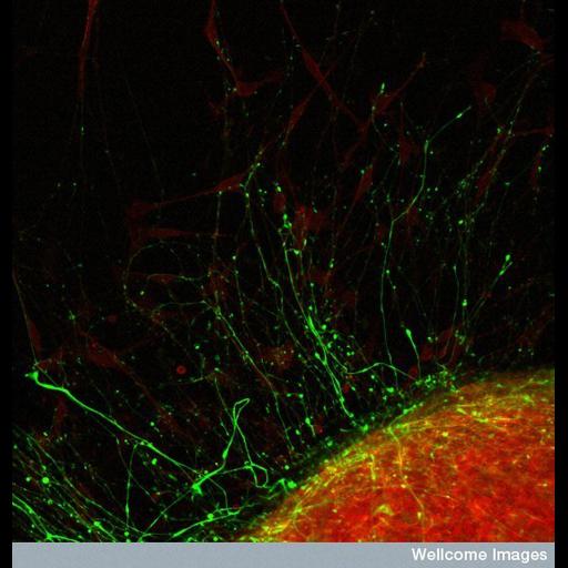  Cell Types:neuron of the dorsal spinal cord Cell Components:actin cytoskeleton, neurofilament cytoskeleton, neuronal cell body, neuron projection, growth cone; Biological process:neuron migration