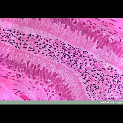  Cell Types:sperm, duct epithelial cell, smooth muscle cell; Cell Components:microvillus Biological process:sperm ejaculation