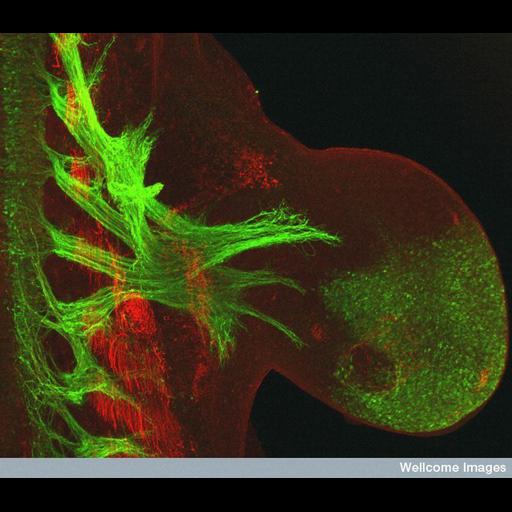  NCBI Organism:Mus musculus; Cell Types:motor neuron Cell Components:neuron projection, myosin complex, , ; Biological process:neuron development, , muscle structure development;