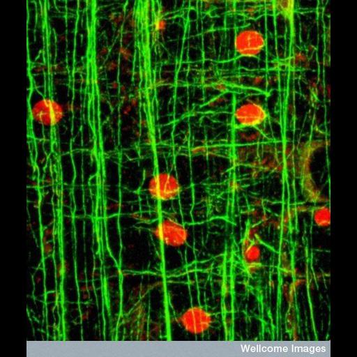  NCBI Organism:Populus; Cell Components:actin cytoskeleton, nucleus; Biological process:cytoskeleton organization