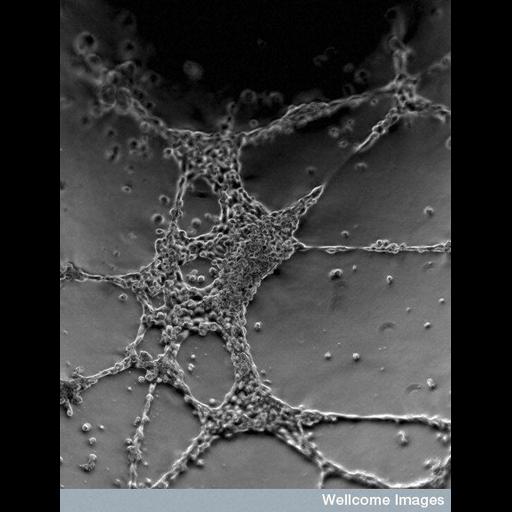  NCBI Organism:Homo sapiens; Cell Types:blood vessel endothelial cell Cell Components:cell surface Biological process:angiogenesis, angiogenesis involved in coronary vascular morphogenesis;