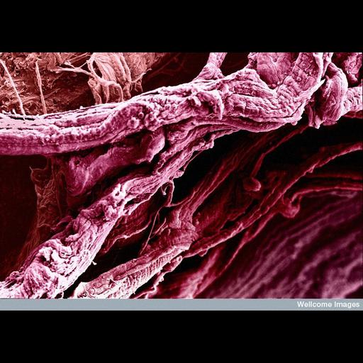  Cell Types:muscle cell Cell Components:myofibril