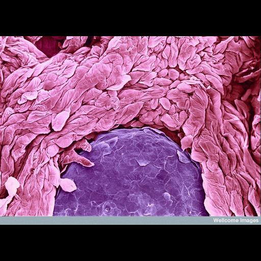  NCBI Organism:Homo sapiens; Cell Components:cell surface