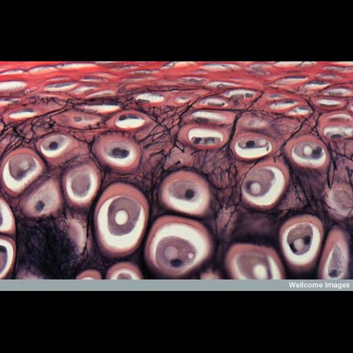  Cell Types:chondrocyte Cell Components:fibrillar collagen, elastic fiber; Biological process:cartilage morphogenesis