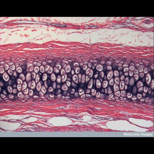  Cell Types:chondrocyte Cell Components:fibrillar collagen, elastic fiber; Biological process:cartilage morphogenesis