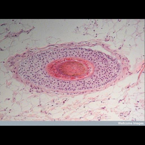  Cell Types:muscle cell, hair follicle cell; Cell Components:keratin filament