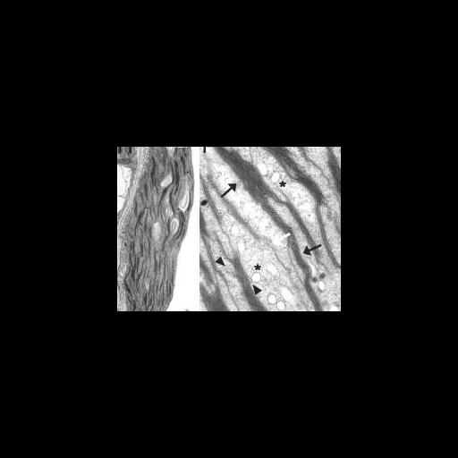  NCBI Organism:Arabidopsis thaliana; Cell Components:chloroplast, plastid thylakoid, granum; Biological process:C4 photosynthesis, organelle organization;