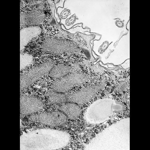  NCBI Organism:Paramecium caudatum; Cell Types:cell by organism, eukaryotic cell, , ; Cell Components:coated pit, cell cortex, mitochondrion, glycogen granule; Biological process:cortical cytoskeleton organization, cytoplasm organization;