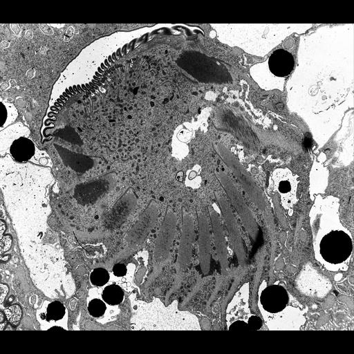  NCBI Organism:Nassula; Cell Types:cell by organism, eukaryotic cell, , ; Cell Components:oral apparatus, ; Biological process:oral apparatus organization, microtubule bundle formation;