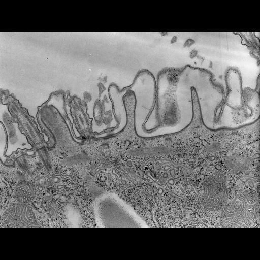  NCBI Organism:Paramecium caudatum; Cell Types:cell by organism, eukaryotic cell, , ; Cell Components:coated pit, cell cortex, mitochondrion, glycogen granule; Biological process:cortical cytoskeleton organization, cytoplasm organization;