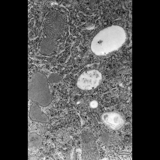  NCBI Organism:Paramecium caudatum; Cell Types:cell by organism, eukaryotic cell, , ; Cell Components:coated pit, cell cortex, mitochondrion, glycogen granule; Biological process:cortical cytoskeleton organization, cytoplasm organization;