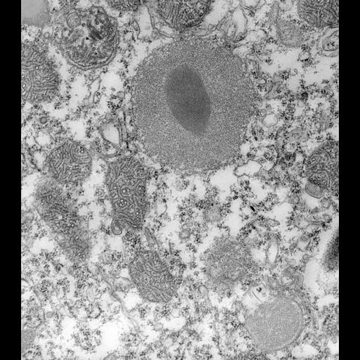  NCBI Organism:Paramecium caudatum; Cell Types:cell by organism, eukaryotic cell, , ; Cell Components:trichocyst, autophagic vacuole; Biological process:organelle assembly, autolysis;