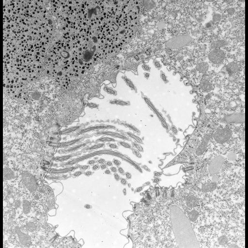  NCBI Organism:Paramecium caudatum; Cell Types:cell by organism, eukaryotic cell, , ; Cell Components:oral apparatus Biological process:oral apparatus organization