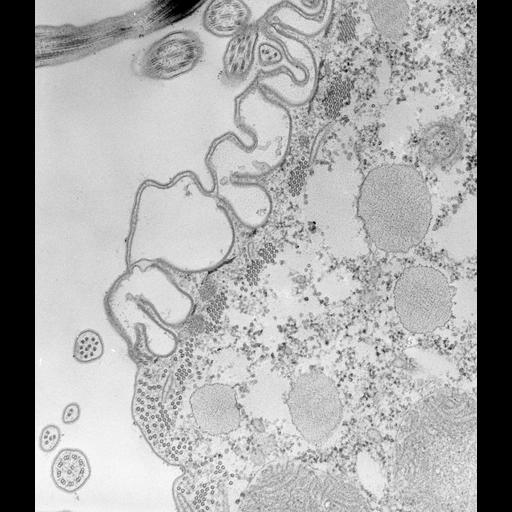  NCBI Organism:Paramecium caudatum; Cell Types:cell by organism, eukaryotic cell, , ; Cell Components:oral apparatus Biological process:oral apparatus organization