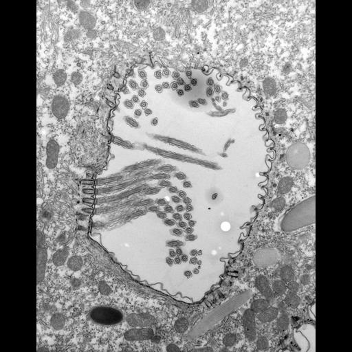  NCBI Organism:Paramecium caudatum; Cell Types:cell by organism, eukaryotic cell, , ; Cell Components:oral apparatus Biological process:oral apparatus organization