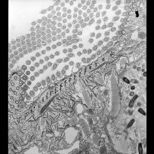  NCBI Organism:Paramecium caudatum; Cell Types:cell by organism, eukaryotic cell, , ; Cell Components:oral apparatus Biological process:phagocytosis, digestion;